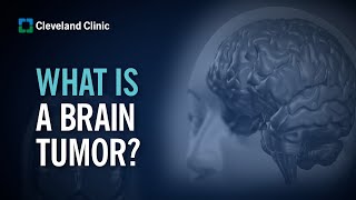 Primary Brain Tumors  What Are They and How Do They Form [upl. by Aspasia]