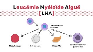 Types de leucémie myéloïde aiguë [upl. by Antonin]