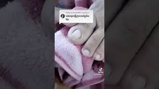 Step by step how to save ingrown toenail ធ្វើក្រចក nail​​​ asmr fyp ear shorts viral wax [upl. by Enaasiali448]