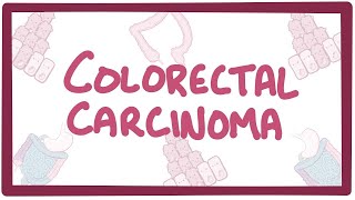 Colorectal carcinoma  causes symptoms diagnosis treatment pathology [upl. by Aneba]