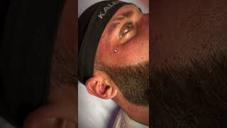 Face Dermal Piercing ⚠️ Sensitive content [upl. by Mungo]