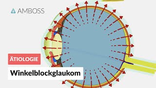 Akutes Winkelblockglaukom bei Pupillarblock  AMBOSS Video [upl. by Garner]