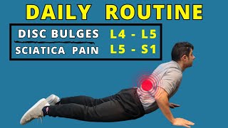 L4 L5 L5 S1 disc bulges best home exercises for pain relief [upl. by Bonar]