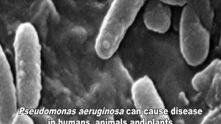 Pseudomonas aeruginosa Infections [upl. by Aceber]