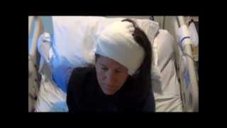 GBM Brain Tumor Surgery Survivor [upl. by Braca]