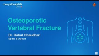 Osteoporotic Vertebral Fracture  Dr Rahul Chaudhari  Manipal Hospital Baner [upl. by Nuarb]