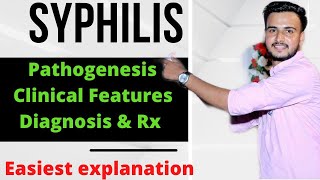 Syphilis Microbiology  Syphilis in Hindi  VDRL TEST [upl. by Arraic]