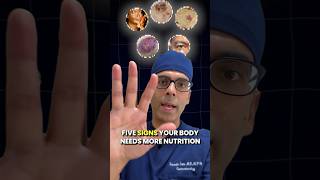 Doctor Sethi  5 Signs Your Body Needs More Nutrients ‼️🚨 [upl. by Tezzil828]