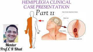 HEMIPLEGIA Clinical case presentation Part 2 [upl. by Enej984]