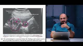 Ep 94 Gastroschisis8 case study CS amp premature deliveryDr Khaled Salah gastroschisis premature [upl. by Brink]