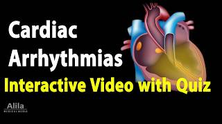 NEW INTERACTIVE Animation with Quiz Cardiac Arrhythmias [upl. by Belac]