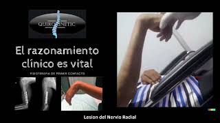 Lesión del nervio radial por fractura humeral [upl. by Elacim721]