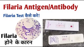 microfilaria antibody test I filaria antigen test [upl. by Jardena708]