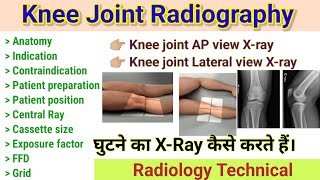 Knee joint Radiography  Knee AP view Xray  Knee Lateral view Xray knee Xray Projections [upl. by Tremayne442]