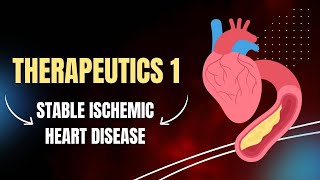 Therapeutics1  stable Ischemic Heart Disease [upl. by Leifeste]