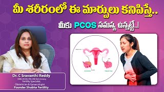 PCOS Polycystic Ovary Syndrome Diagnose amp Symptoms in Telugu  ShubhaFertility [upl. by Ahsekad394]