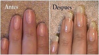 Cuanto Crecen Las Uñas en 3 Meses [upl. by Analat108]