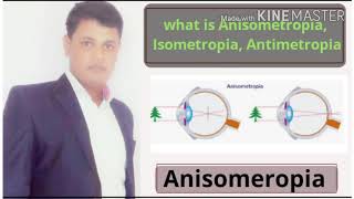 Anisometropia  Isometropia  Antimetropia  Simple  Compound  Mixed anisometropia  treatment [upl. by Gilly191]