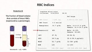 How to Interpret RBC Indices eg hemoglobin vs hematocrit MCV RDW [upl. by Ettenil]