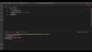 IndentationError unexpected indent Problem Solve Python VSCODE [upl. by Ahsiemaj]