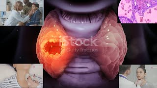 Tumor Markers  Calcitonin  Medullary Thyroid Cancer MTC  The quotbutterflyquot organ  08 [upl. by Conlin]