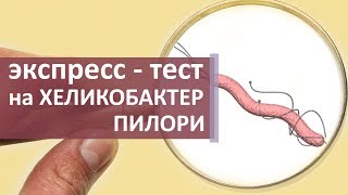 Тест на Хеликобактер пилори 🔬 Как делают уреазный экспресс  тест на Хеликобактер пилори [upl. by Asiat]