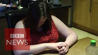 Narcolepsy What is it like to have a cataplexy attack  BBC News [upl. by Uticas]