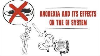 How anorexia affects the digestive system [upl. by Itsirhc]