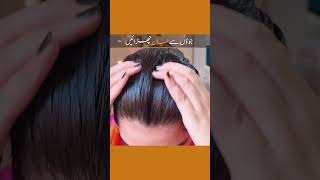 Head lice removal tip headlice liceremoval haircare hairgoals shumailasdiary [upl. by Anthiathia]