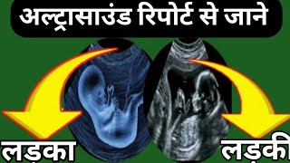 ultrasound report se kaise pata Karen ladka ya ladki बेटा होने के सबसे ठोस लक्षणbabyboy anomly [upl. by Llerrom]