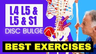 L4 L5 amp L5 S1 Disc Bulge Best Exercises Rehab For Relief [upl. by Den446]