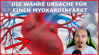 Die WAHRE Ursache des HERZMUSKELINFARKTS MyokardInfarkt [upl. by Himelman57]