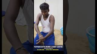 elbow dislocation treatment  முழங்கை மூட்டு விலகல்  vadapalani  puttur kattu [upl. by Beeson]