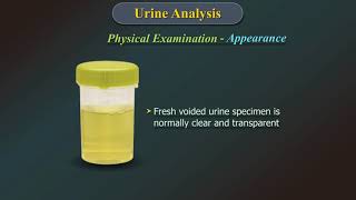 Urine Analysis [upl. by Lucier]