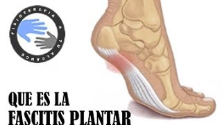 Fascitis plantar que es y como se produce [upl. by Sargent698]