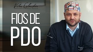 FIOS de PDO  Como funcionam os Fios de Sustentação do rosto  Sutura  Dr Vitor Erlacher [upl. by Halimeda]