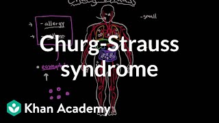 ChurgStrauss syndrome  Circulatory System and Disease  NCLEXRN  Khan Academy [upl. by Leugim758]