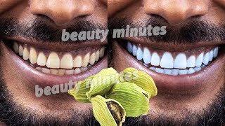 Teeth whitening at home in 3 minutes  How to naturally whiten your yellow teeth 100 effective [upl. by Refinnaj]