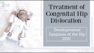 congenital hip dislocation treatment  Developmental Dysplasia of the Hip DDH [upl. by Sitelc576]