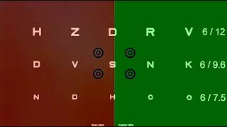 2 Application in 1 system Vision Chart display Best for all your eye screening project [upl. by Handbook]