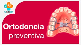 Ortodoncia Preventiva  Tu Salud Guía [upl. by Akcired947]