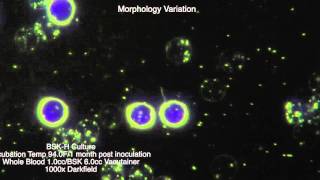 Spirochete Morphology [upl. by Ain]