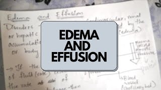 Edema and Effusion  Haemodynamic Pathology [upl. by Martinez622]