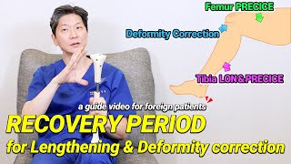 RECOVERY PERIOD for lengthening amp deformity correction surgery [upl. by Kentiggerma]