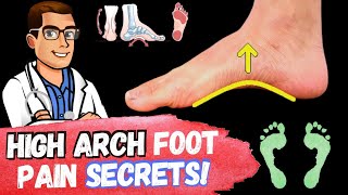 FIX High Arches amp High Arch Feet Supination amp Pes Cavus Foot Type [upl. by Coltun]