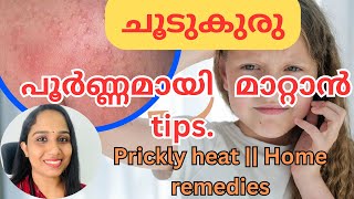 ചൂടുകുരു പൂർണ്ണമായി മാറ്റാൻ tips Prickly heat homeremedies malayalam health summer ചൂടുകുരു [upl. by Acillegna]