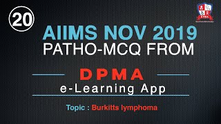 Burkitts Lymphoma AIIMS nov 2019 by Dr Devesh Mishra [upl. by Yevette267]