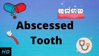 Abscessed tooth Causes SIgns and Symptoms Diagnosis and Treatment [upl. by Kitrak]