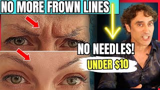 QUICKLY and EASILY GET RID OF YOUR FROWN LINES [upl. by Damick]