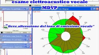 CORDECTOMIA RIABILITAZIONE [upl. by Burta439]